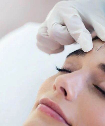 Aplicação de Botox, como funciona? Mitos e verdades do procedimento