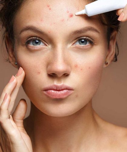 o que causa, como evitar e tratar