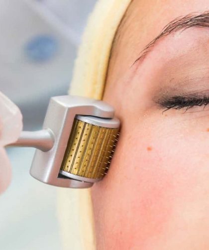 Riscos do microagulhamento, quais são? Como evitar