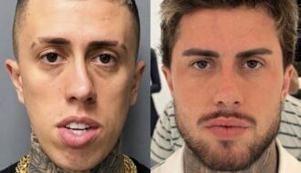 Rennova assina transformação estética de MC e resultado chama atenção nas redes