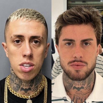Rennova assina transformação estética de MC e resultado chama atenção nas redes