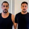 Ex-BBB Maike Allan faz harmonização facial e explica receio de perder a naturalidade
