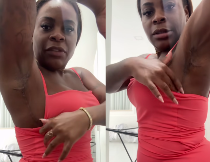 Jojo Todynho mostra cicatrizes de novo procedimento cirúrgico após emagrecimento Jojo Todynho mostra cicatrizes de novo procedimento cirúrgico após emagrecimento