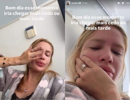 Karoline Lima chama atenção para pele, mas detalhe rouba a cena Karoline Lima chama atenção para pele, mas detalhe rouba a cena