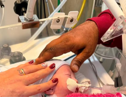 Bebê dado como morto volta a se mexer em saco funerário após 2 horas em hospital de SP