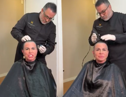 Gretchen raspa a cabeça em transmissão ao vivo antes de passar por transplante capilar