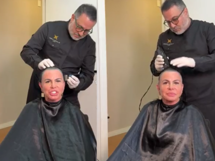 Gretchen raspa a cabeça em transmissão ao vivo antes de passar por transplante capilar