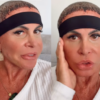Gretchen atualiza sobre recuperação após realizar transplante capilar