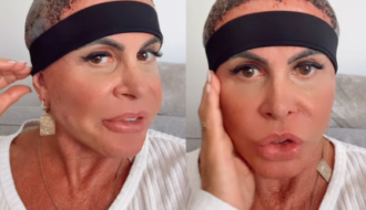 Gretchen atualiza sobre recuperação após realizar transplante capilar