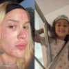Karoline Lima mostra rosto após procedimento e filha pede maquiagem: “Fazer outra em você”