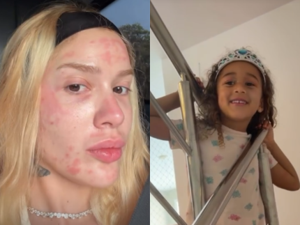 Karoline Lima mostra rosto após procedimento e filha pede maquiagem: “Fazer outra em você”
