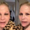 Monique Evans revela perrengue com banco após cirurgia facial: “Não me reconheceram”