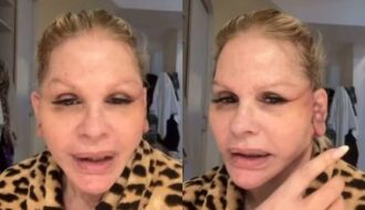 Monique Evans revela perrengue com banco após cirurgia facial: “Não me reconheceram”
