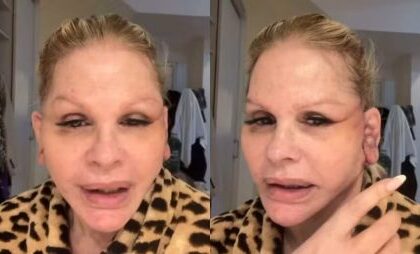 Monique Evans revela perrengue com banco após cirurgia facial: “Não me reconheceram” Monique Evans revela perrengue com banco após cirurgia facial: “Não me reconheceram”