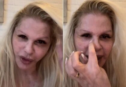 Monique Evans mostra rosto sete dias após cirurgia plástica: “Estou apaixonada” Monique Evans mostra rosto sete dias após cirurgia plástica: “Estou apaixonada”