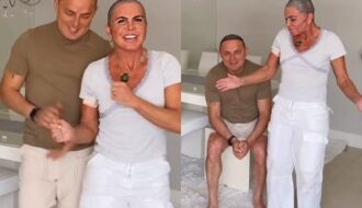 Gretchen revela que marido também fez transplante capilar: “Vai ficar com franjão”