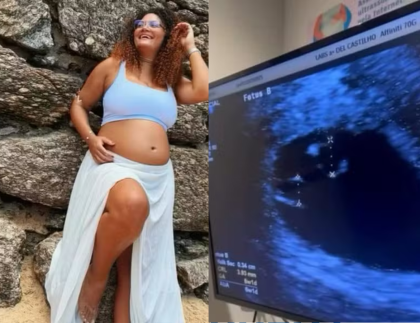Em dose tripla! Mulher engravida de 3º bebê durante gestação de gêmeos no RJ