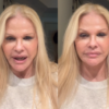 Monique Evans comemora resultado de cirurgia facial: “Chocada com a minha cara”