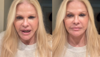 Monique Evans comemora resultado de cirurgia facial: “Chocada com a minha cara”