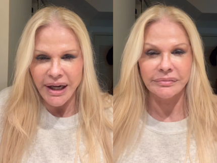 Monique Evans comemora resultado de cirurgia facial: “Chocada com a minha cara”